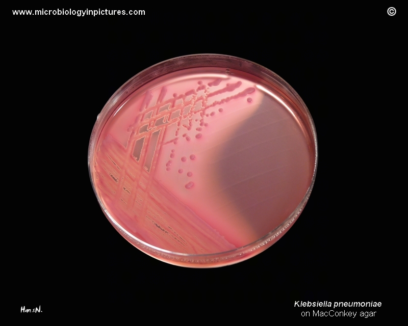 K.pneumoniae in Petri dish